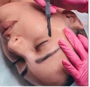 Dermaplaning en Siempre Bella